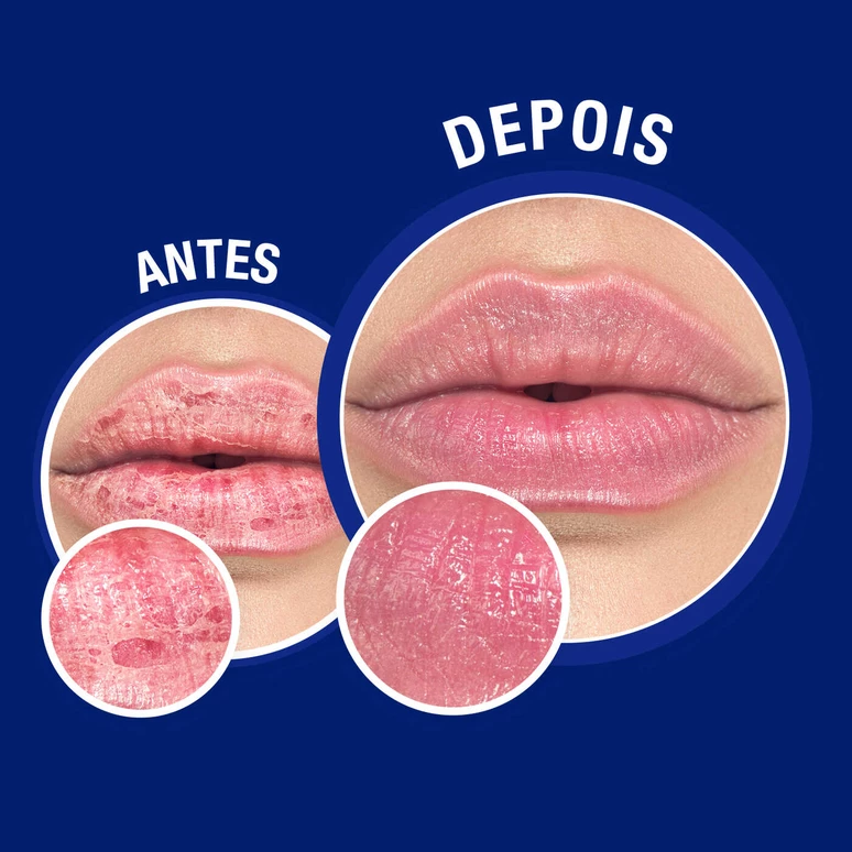 Neutrogena bálsamo labial cica reparação intensa em tubo 15ml DRARTUS Neutrogena bálsamo labial cica reparação intensa em tubo 15ml - Image 4